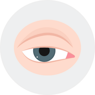 Ptosis Surgery